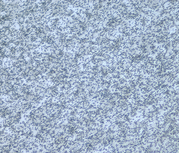 SCM435- Before Quenching and tempering